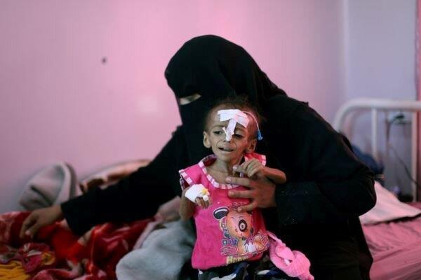وضعیت کنونی یمن بزرگترین بحران بشری در جهان